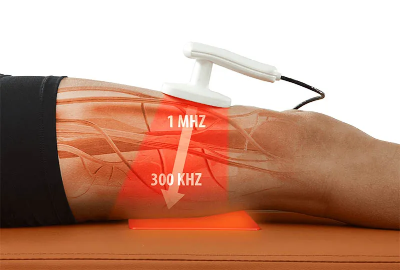 Terapia Tecar aplicación práctica