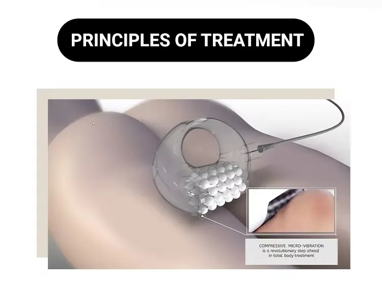 Máquina de modelado corporal con EMS Ring +9d máquina de masaje con bola interna