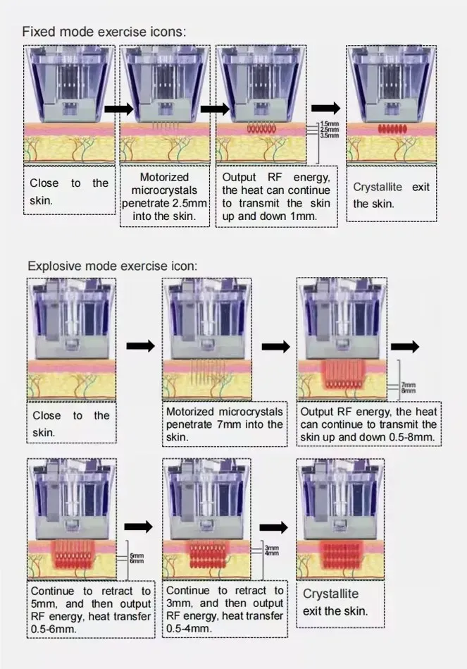 Tratamiento térmico y regeneración de colágeno