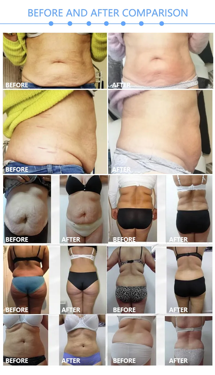 24 Máquina de Presoterapia de Quema de Grasa y Moldeo Corporal con Infrarrojos Lejanos para Pérdida de Peso
