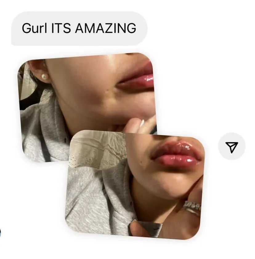 Lip Plumper Features