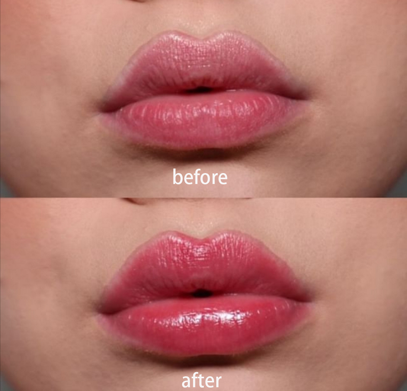 Lip Plumper Pen Packaging
