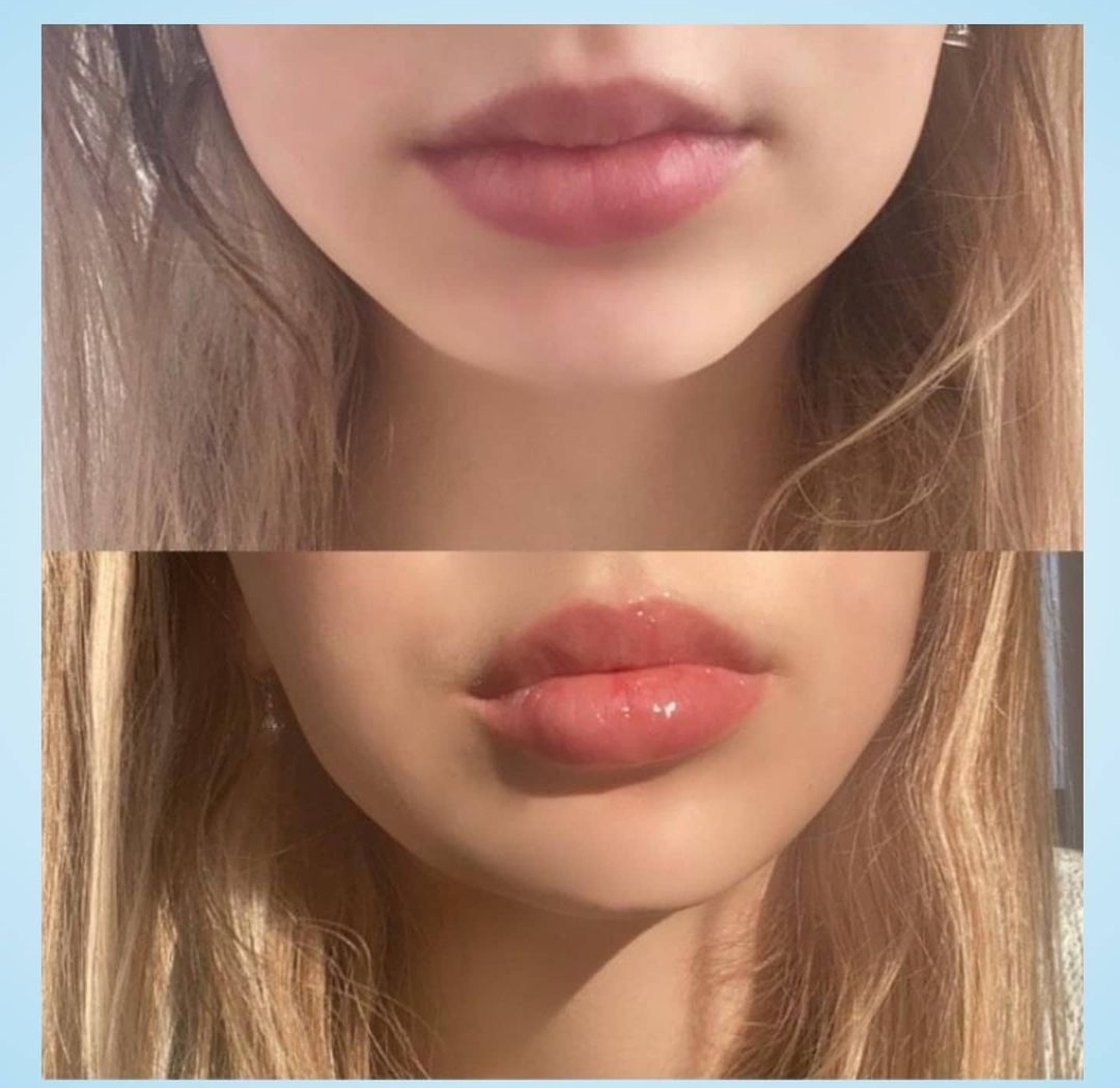 Private Label Lip Plumper Gloss Custom Capsicum Frutescens Fruit Lip Plumper Pen