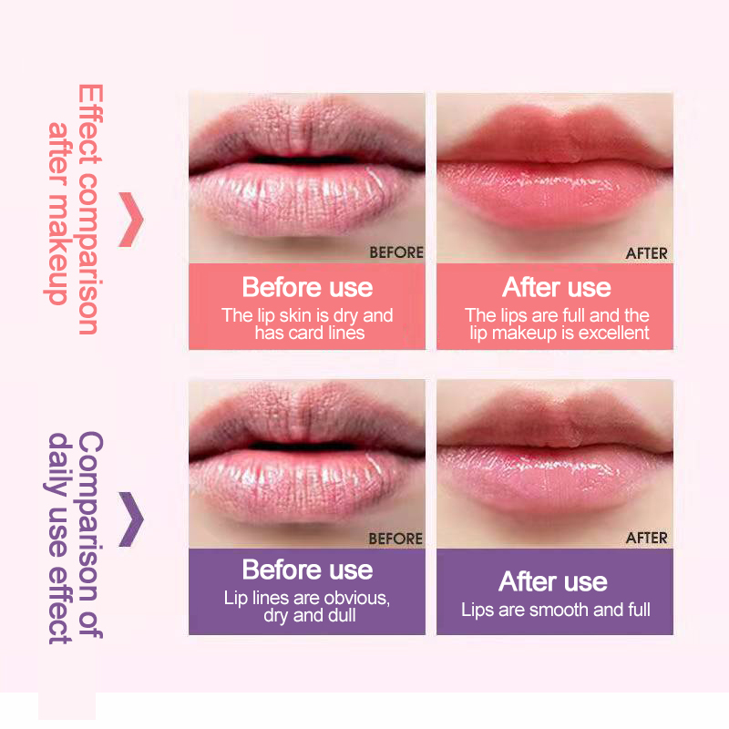 Lip Sleeping Mask View 7