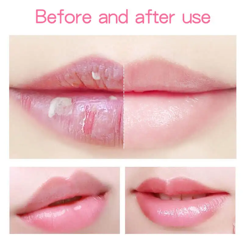 Lip Balm Variation 4