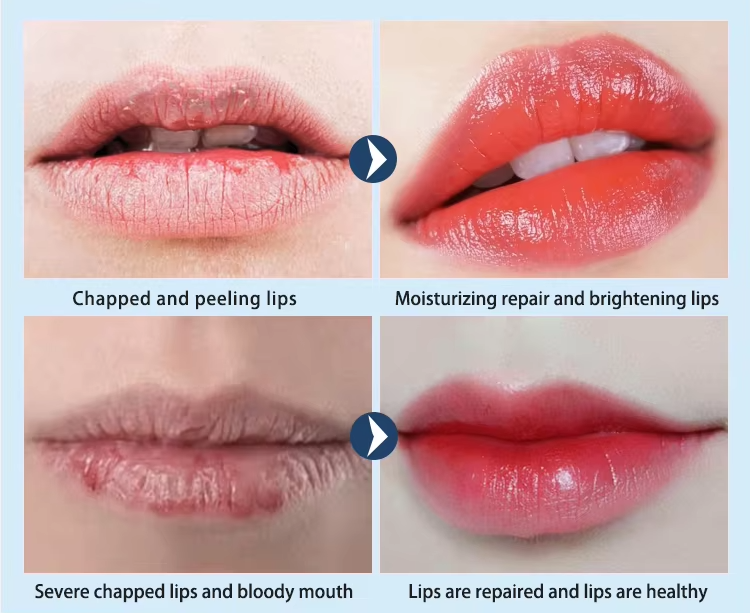 Pink Lip Mask Detail 4