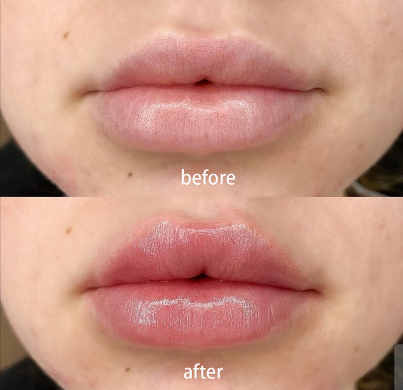 Lip Plumper Pen Tube