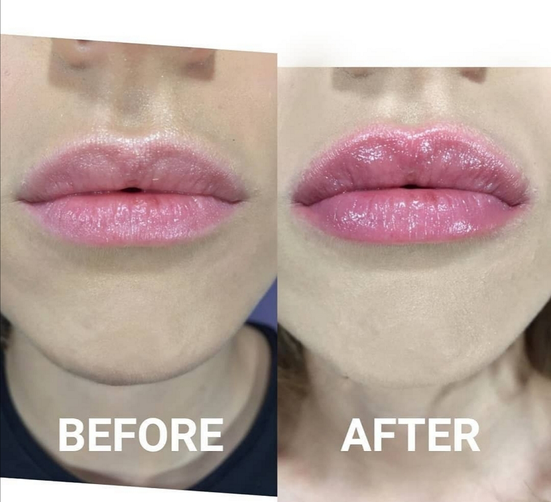 Lip Plumper Pen Usage