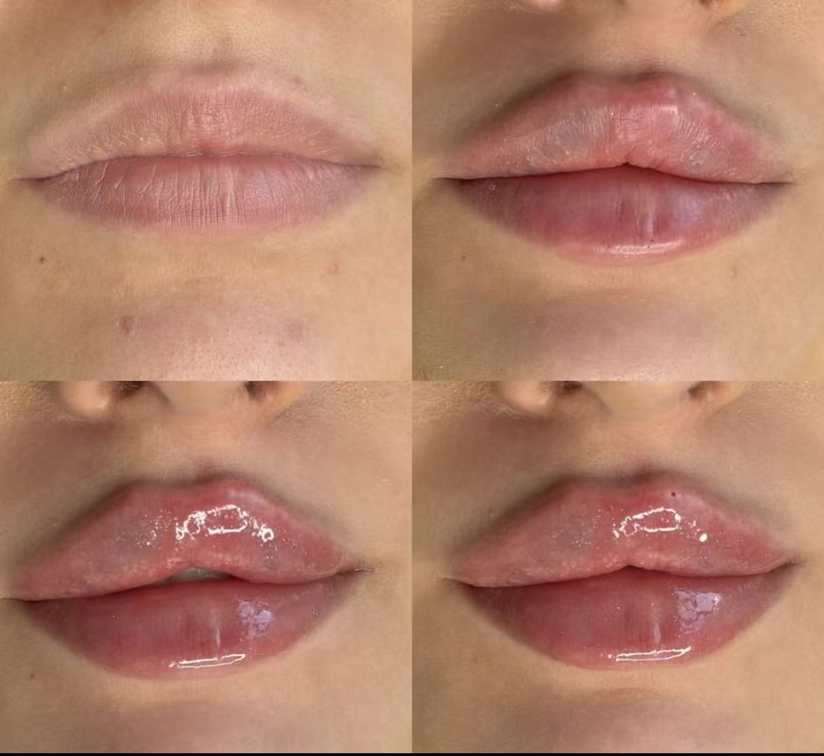Extreme Vegan Lip Plumper with Moisturizing Oil Takes Effect 10-15 Minutes Transparent Texture Lasts Long Harmless Lightweight