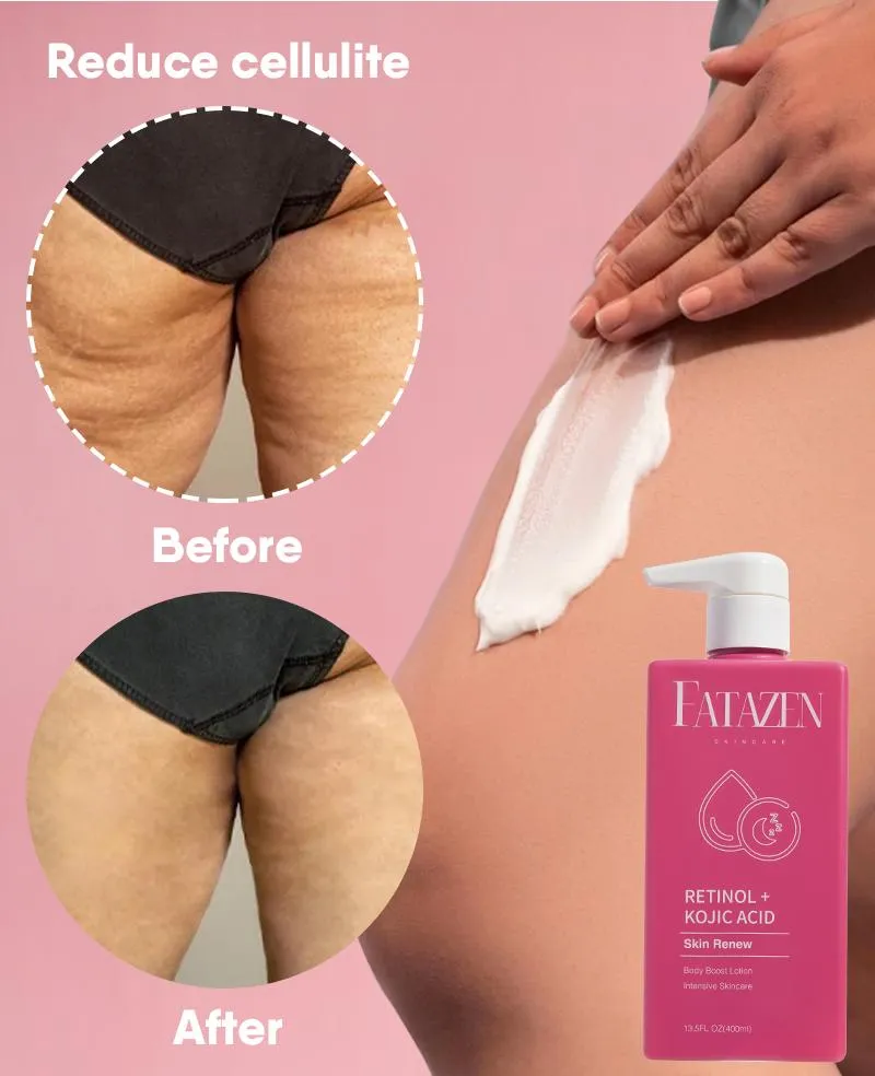 Body Lotion Photo 9