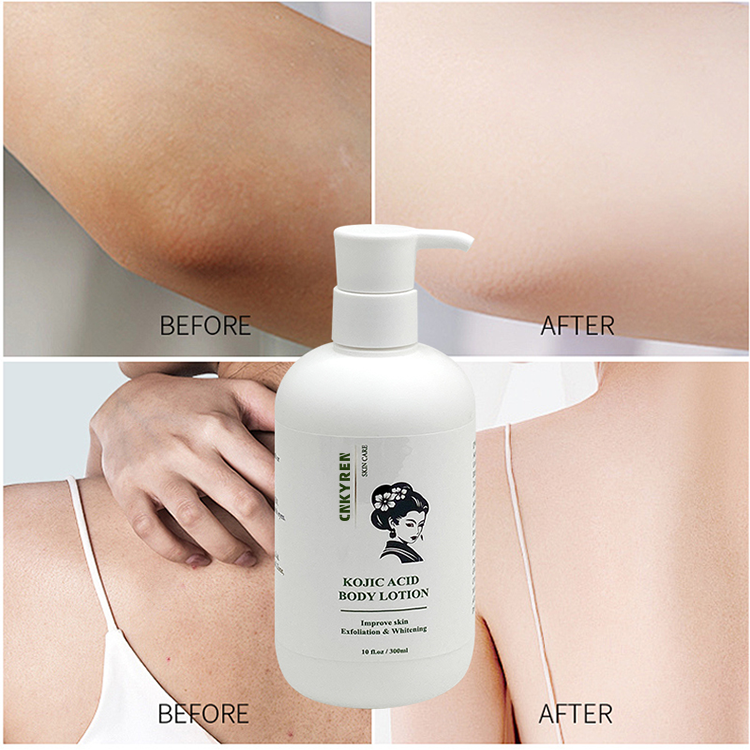 OEM Kojic Acid Body Lotion Skin Whitening Deep Cleansing Moisturizer Skin Brightening Care Body Lotion Improve Skin Exfoliation
