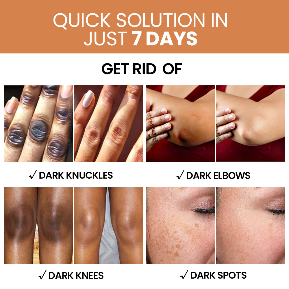 Private Label Skin Whitening Body Cream Strong Bleaching Products Dark Spots Remover Lightening Body Lotion Adults Female