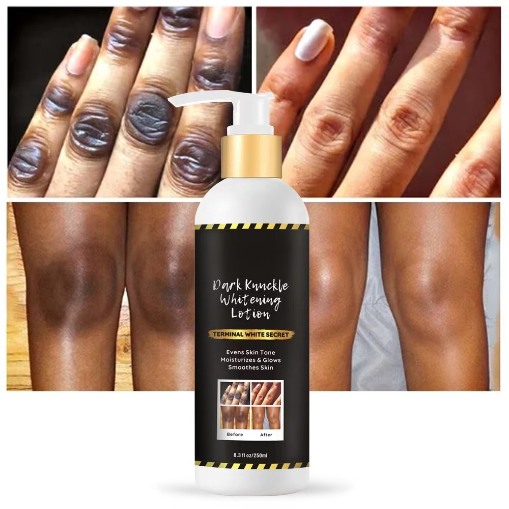 Private Label Skin Whitening Body Cream Strong Bleaching Products Dark Spots Remover Lightening Body Lotion Adults Female