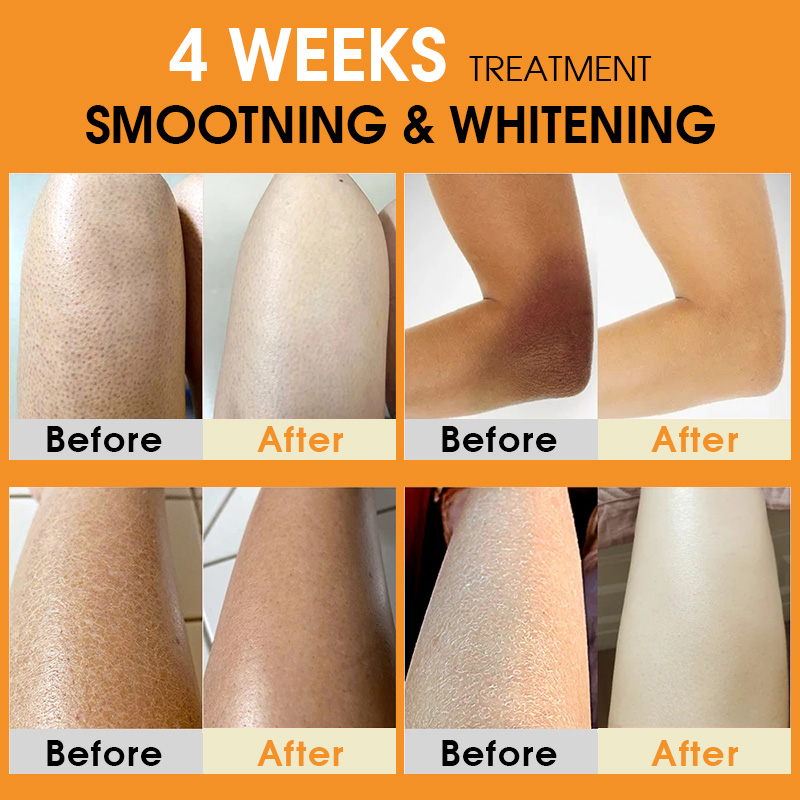 AFCARE Turmeric Whitening Body Cream Niacinamide Hyaluronic Acid Moisturizing Lightening Body Lotion Smooth Skin Care