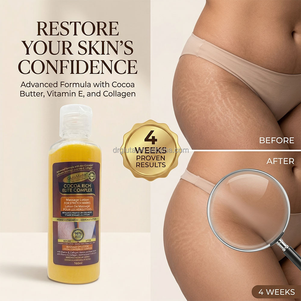 Stretch Marks Lotion 2