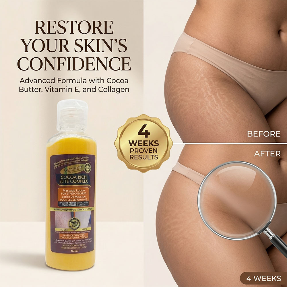 GLuta Master Stretch Marks Body Lotion Nourishing Skin Organic Enriched with Vitamin E Reduce the Appearance of Fine Lines