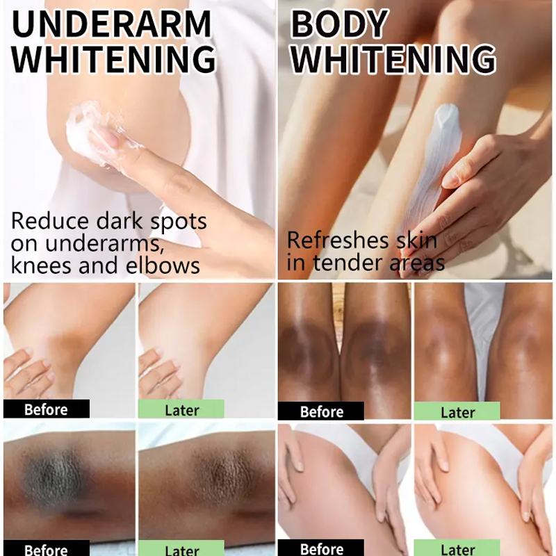 Best Turmeric Body Cream for Dark &amp; Luxury Black Skin Hyaluronic Acid Shea Butter Lightning Body Lotion Bulk