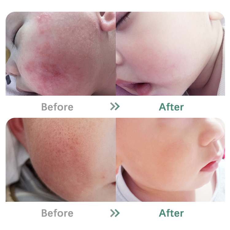 Private Label Natural Organic Sensitive Skin Care Coconuttb Oil Kids Body Lotion Nourishing Moisturizing Baby Balm Cream