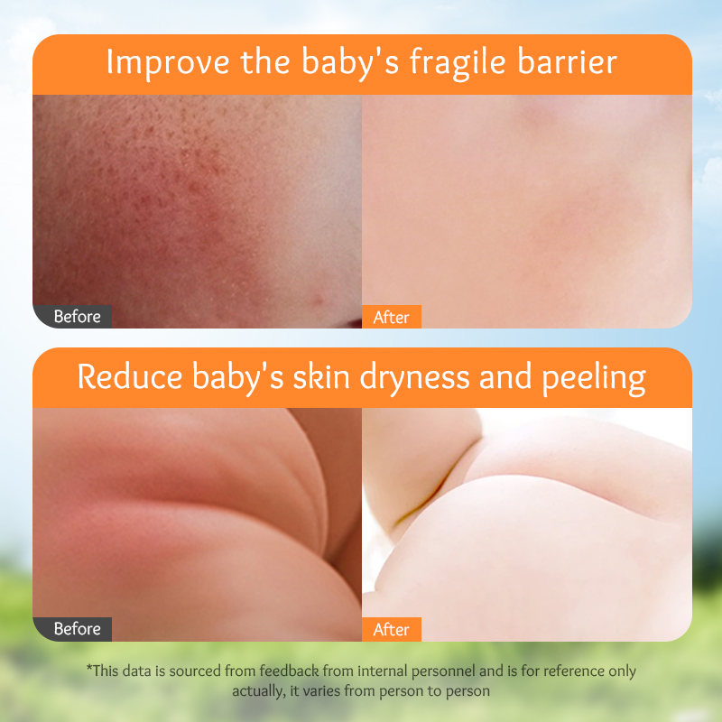 The Most Popular Private Label SADOER Children's Calendula Vitamin E Body Lotion Moisturizing and Hydrating in Autumn and Winter