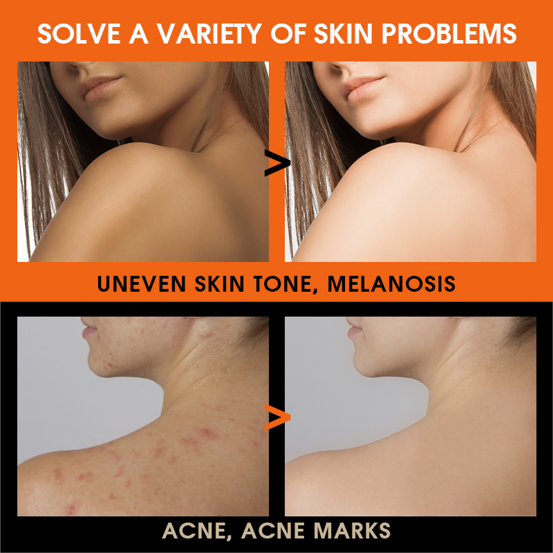 Private Label OEM Organic Skin Repair Whitening Hydrating Soothing Brightening Vitamin C Body Lotion