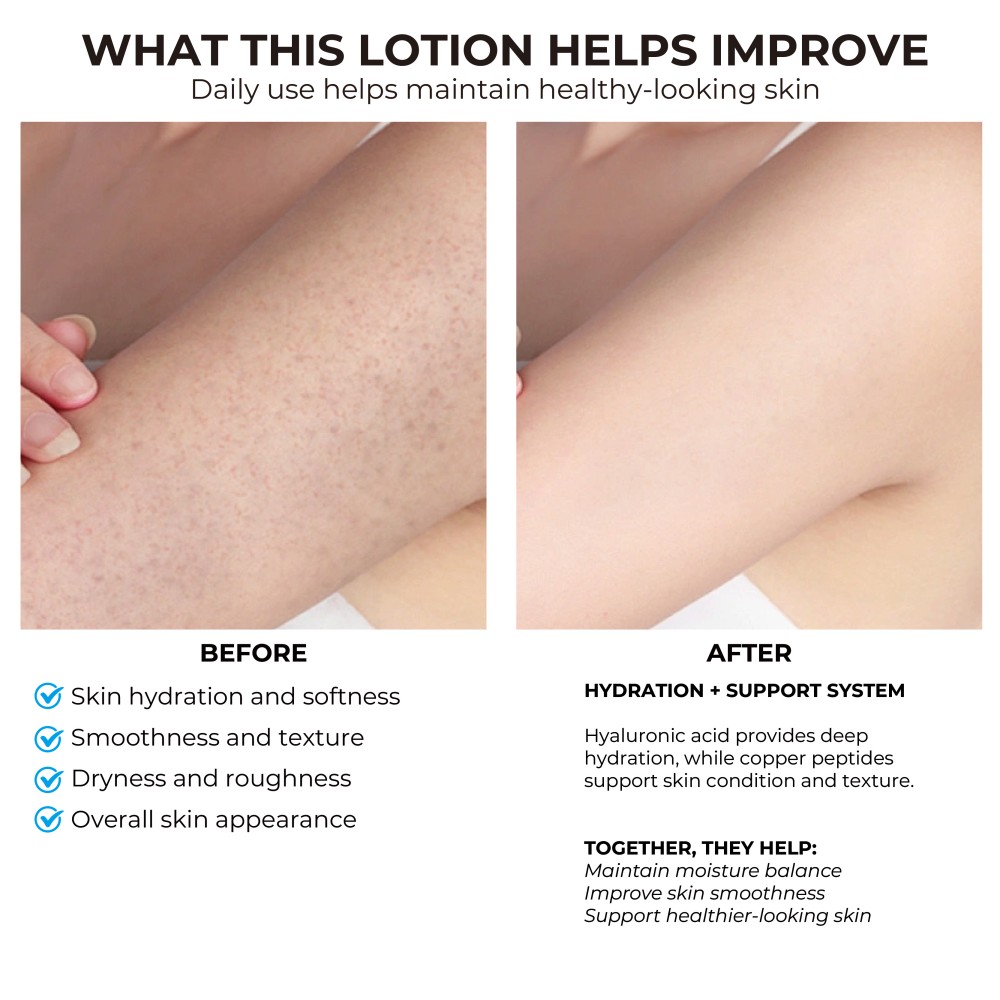 Private Label Copper Peptide Body Lotion GHK-Cu Firming Moisturizing Hyaluronic Acid Smooth Dry Rough Skin 250ml OEM Body Care