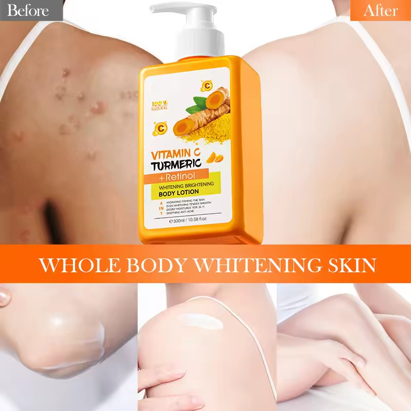 Turmeric body lotion application
