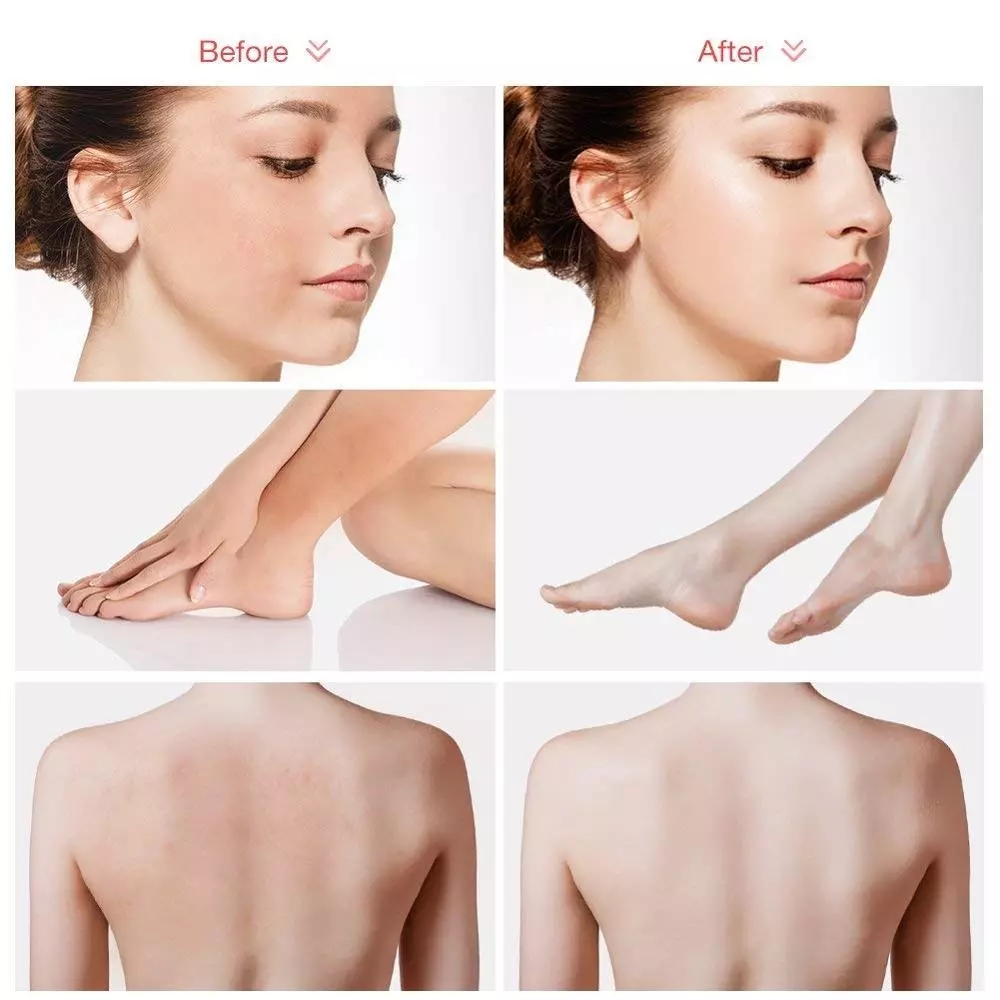 Yogurt Skin Whitening Texture