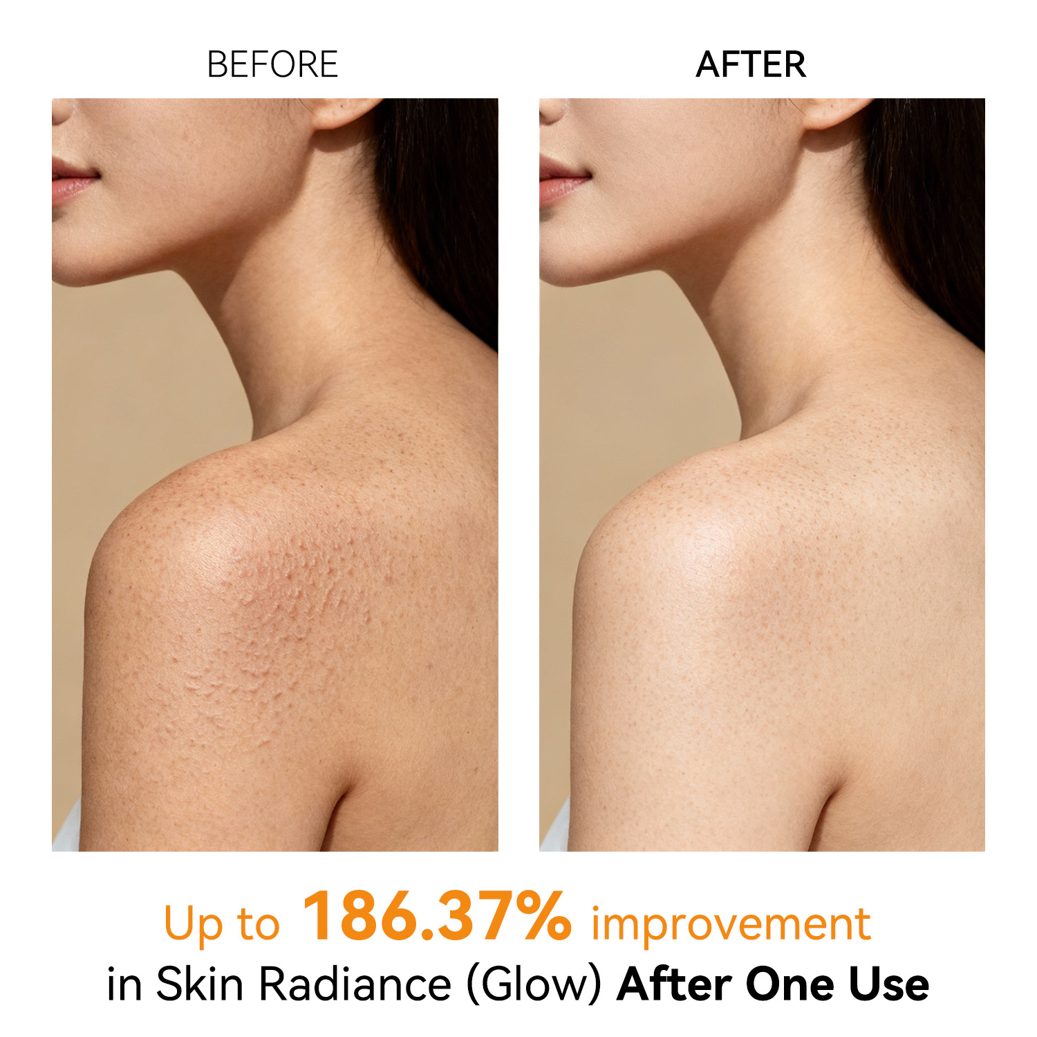 For Branded Luxury Nourishing Body Lotion Aloe Vera Vitamin C Pores Shrinking Acne Pimples Removing Moisturizing Brightening