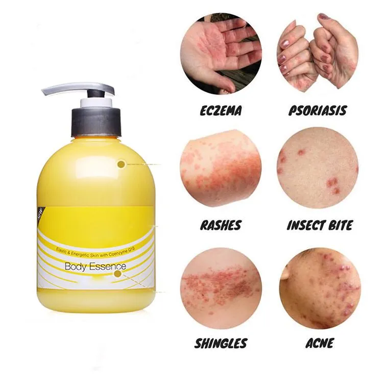 Body Lotion Photo 4