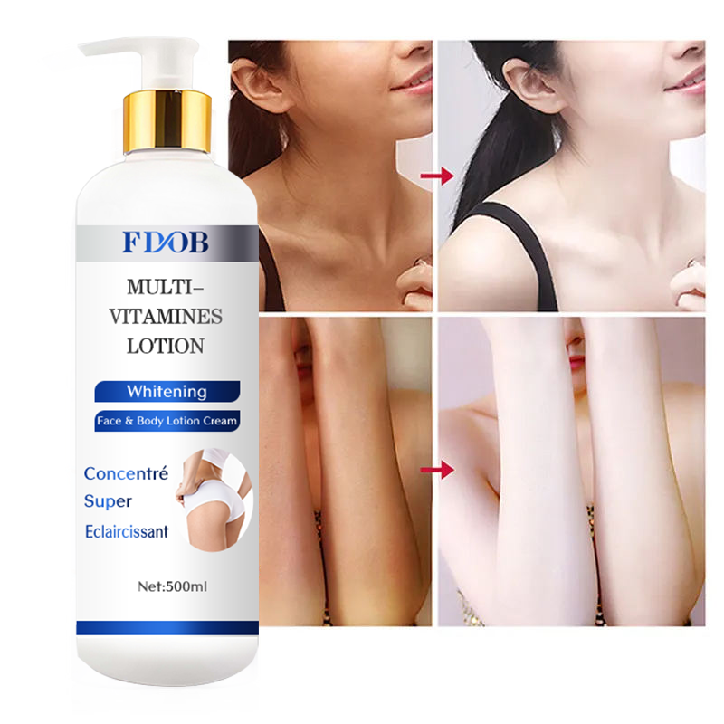 OEM/ODM Strong Whitening Vitamin Enriched Body Lotion for Men | Dark Spot Remover &amp; Moisturizer with Natural Ingredients
