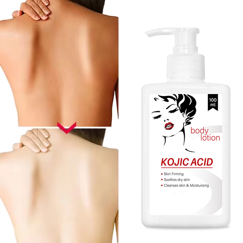 Best Sales 100ml Natural Organic Moisturizing Firming Soothes Dry Skin Kojic Acid Body Lotion