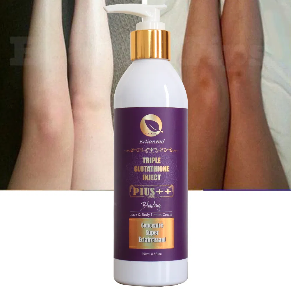Own Brand Vitamin C Deep Moisturizing Skin Treatment Acne Glutathione Whitening Body Lotion