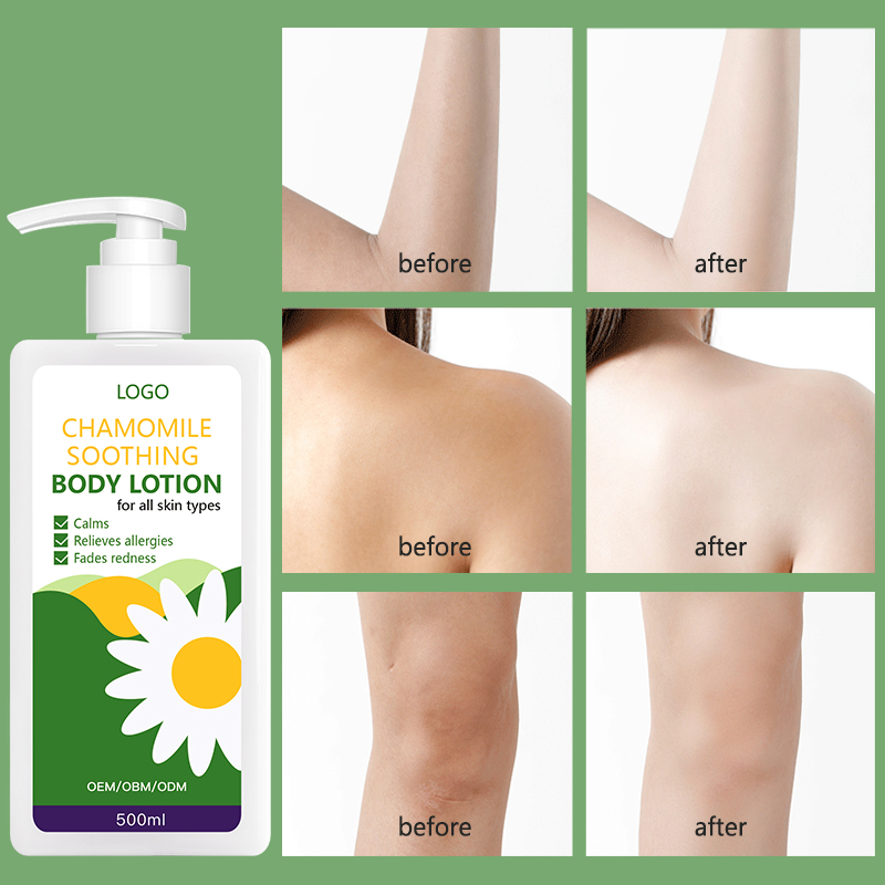 Customized Face and Body Organic Beauty Care Moisturizing Chamomile Body Lotion 500ml for Body Care