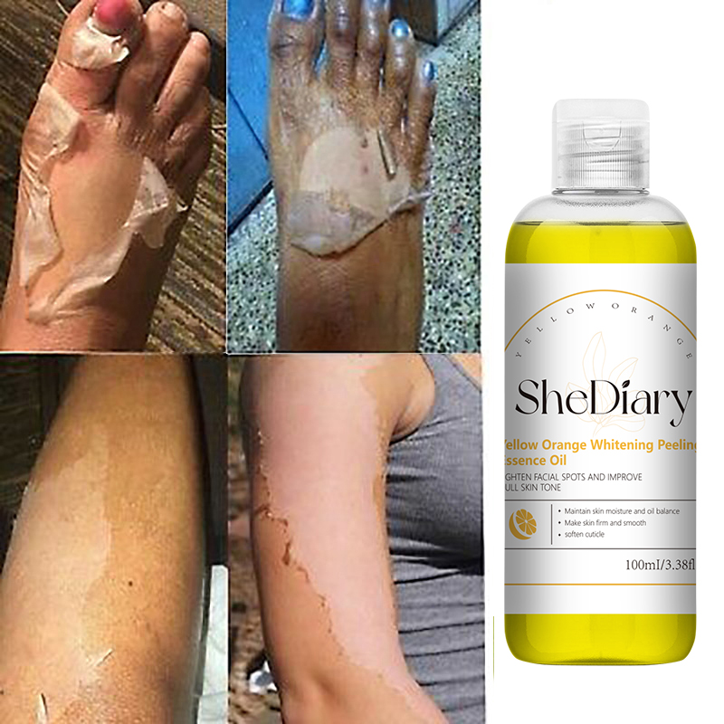 OEM Skin Care Products Skin Exfoliating Peeling Essence Whitening Body Lotion Lightening Whitening Orange Peeling Essence 100ml