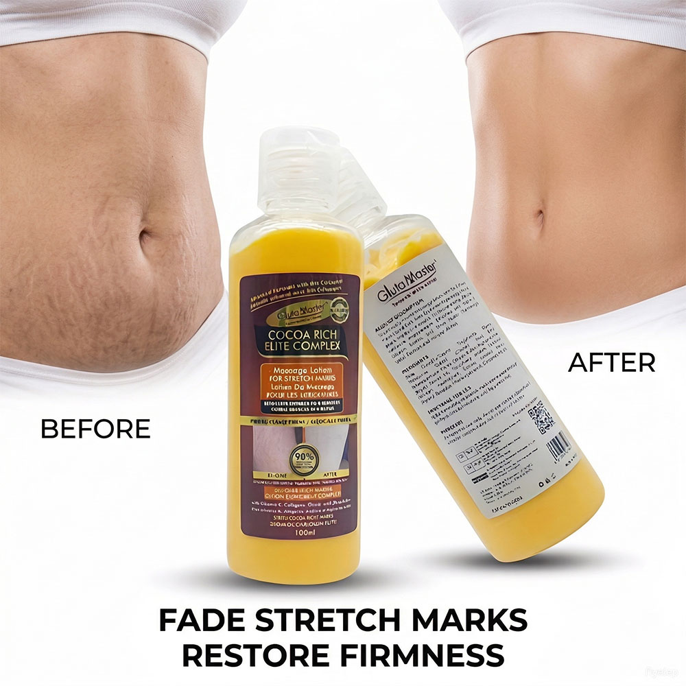 GLuta Master Stretch Marks Body Lotion Nourishing Skin Organic Enriched with Vitamin E Reduce the Appearance of Fine Lines