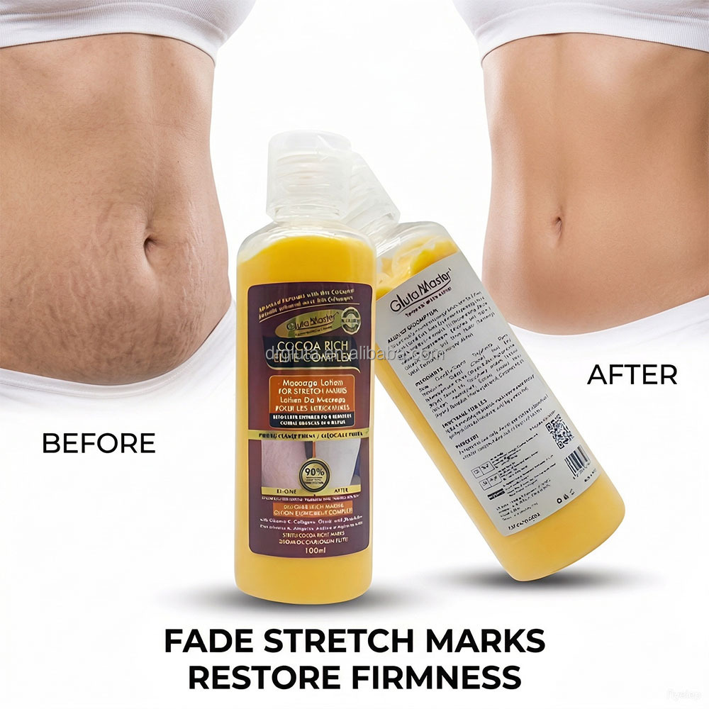 Stretch Marks Lotion 1