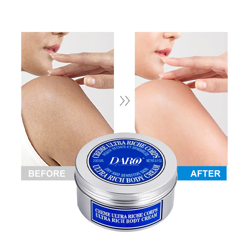Gentle Shea Rich Formula Deep Nourish Rough Skin Body Cream