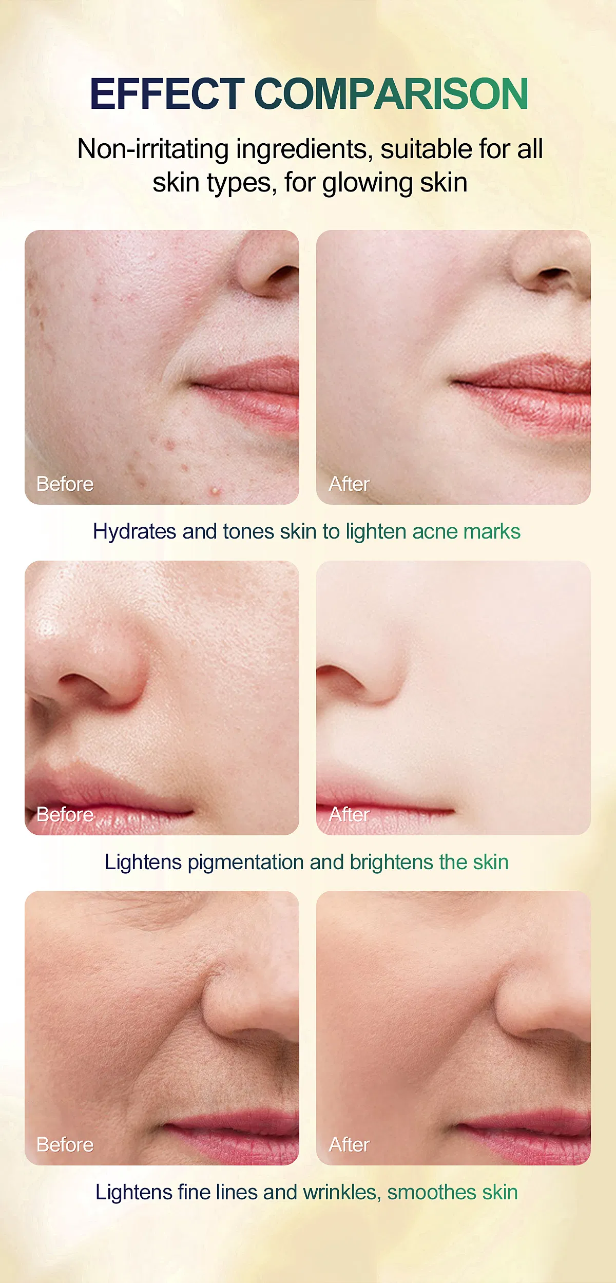 Serum Image