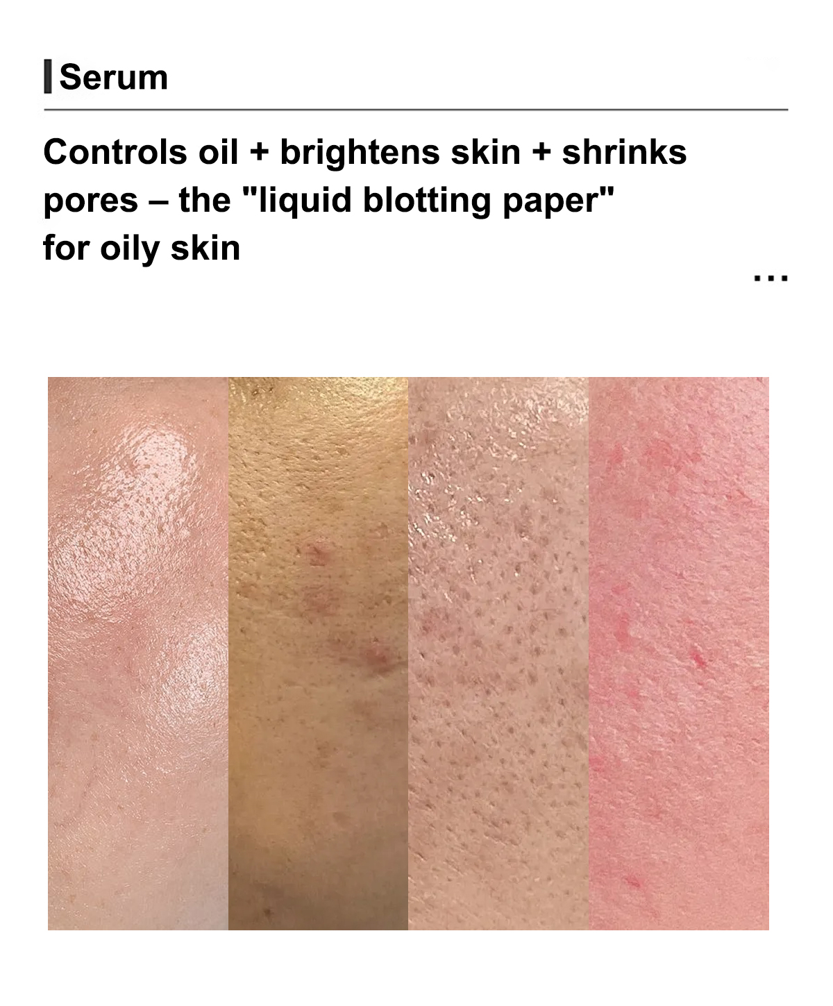 10% Niacinamide 1% Zinc PCA Serum High Concentration Vitamin B3 Facial Essence for Effective Fade Pore Minimizer Refining