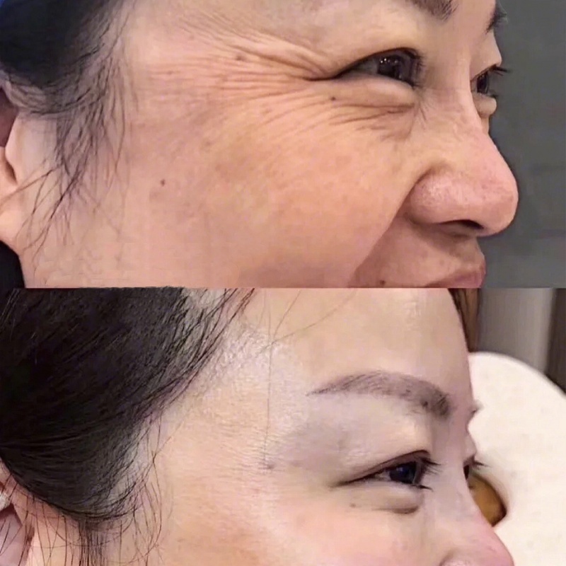 Syn Ake Long Lasting Effect Anti Wrinkle Remover Synthetic Snake Venom Peptide 30 Seconds Instant Wrinkle Firming Eye Care Serum