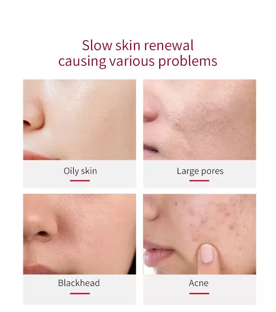OEM Factory Sales Face Care Cosmetic Hyaluronic Acid Moisturizing Hydrating Serum