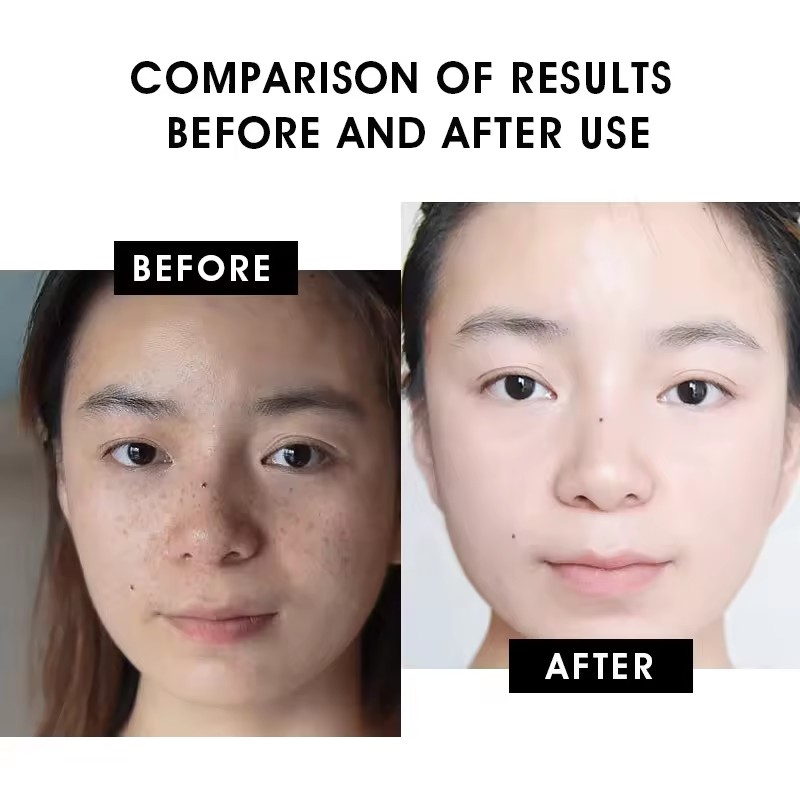 Vitamin C Serum Detail 4