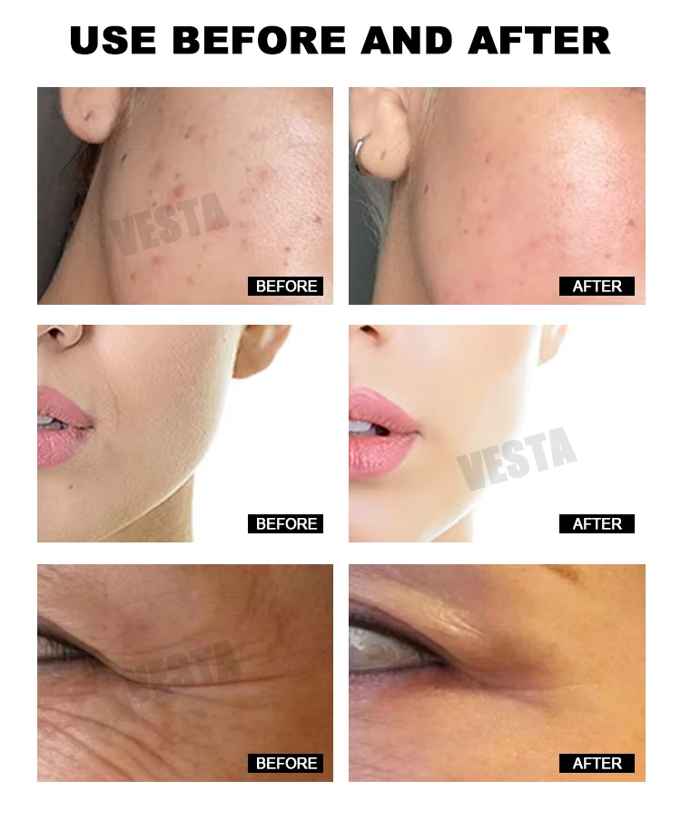 Facial Ampoule Serum Detail 6