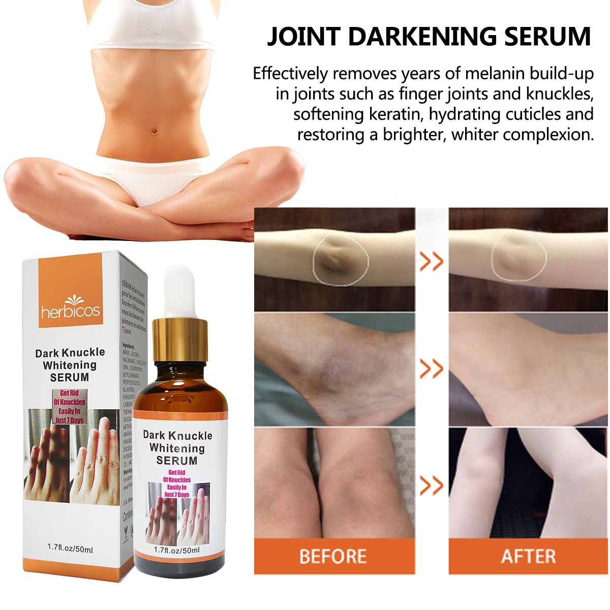 Private Label Organic Moisturizing Brightening 7 Days Dark Knuckle Eraser Oil Remover Whitening Serum