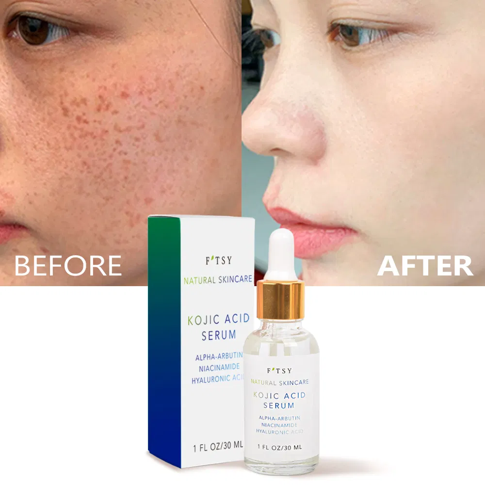 Whitening Kojic Acid Serum