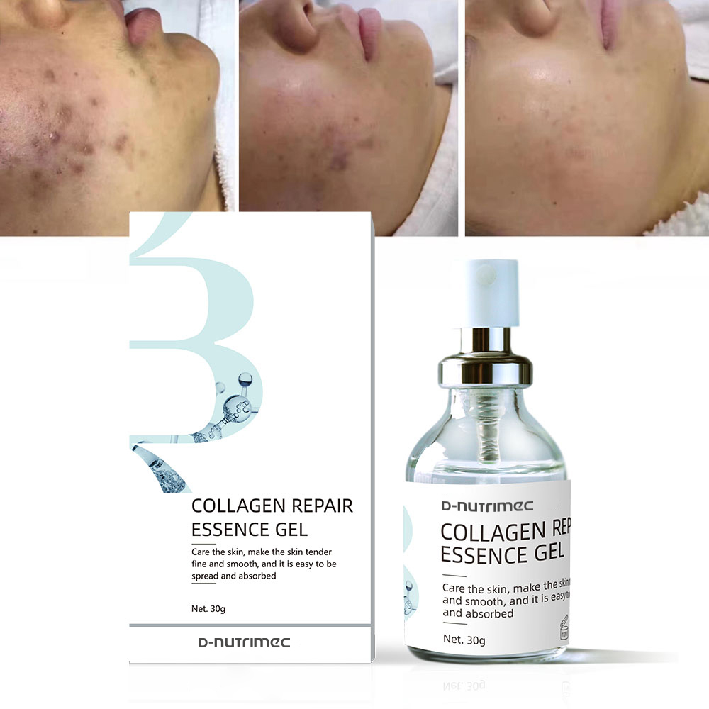 Beauty Face Acne Treatment Whitening Moisturizer Advanced Vegan Face Recombinant Type III Collagen Skincare Serum Gel