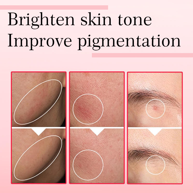 OEM ODM Custom Private Label Vitamin C Niacinamide Hyaluronic Acid Anti-Aging Anti-Wrinkle Whitening Facial Repair Glow Serum