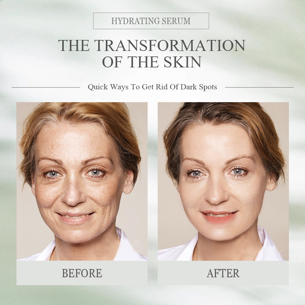 OEM Natural Vitamin C Peptide Anti-Wrinkle Anti-Aging Facial Essence Whitening Liquid Skin Care Private Label Vitamin C Serum