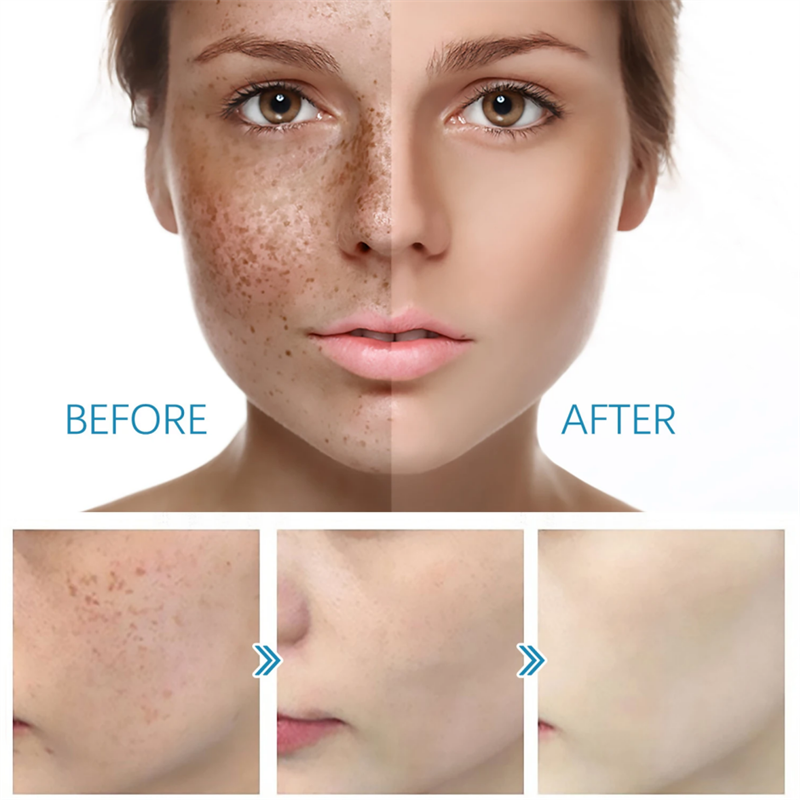 Professional Private Label Professional Hyaluronic Acid Serum De Aging Acne Stem Cell Ampoule Serum
