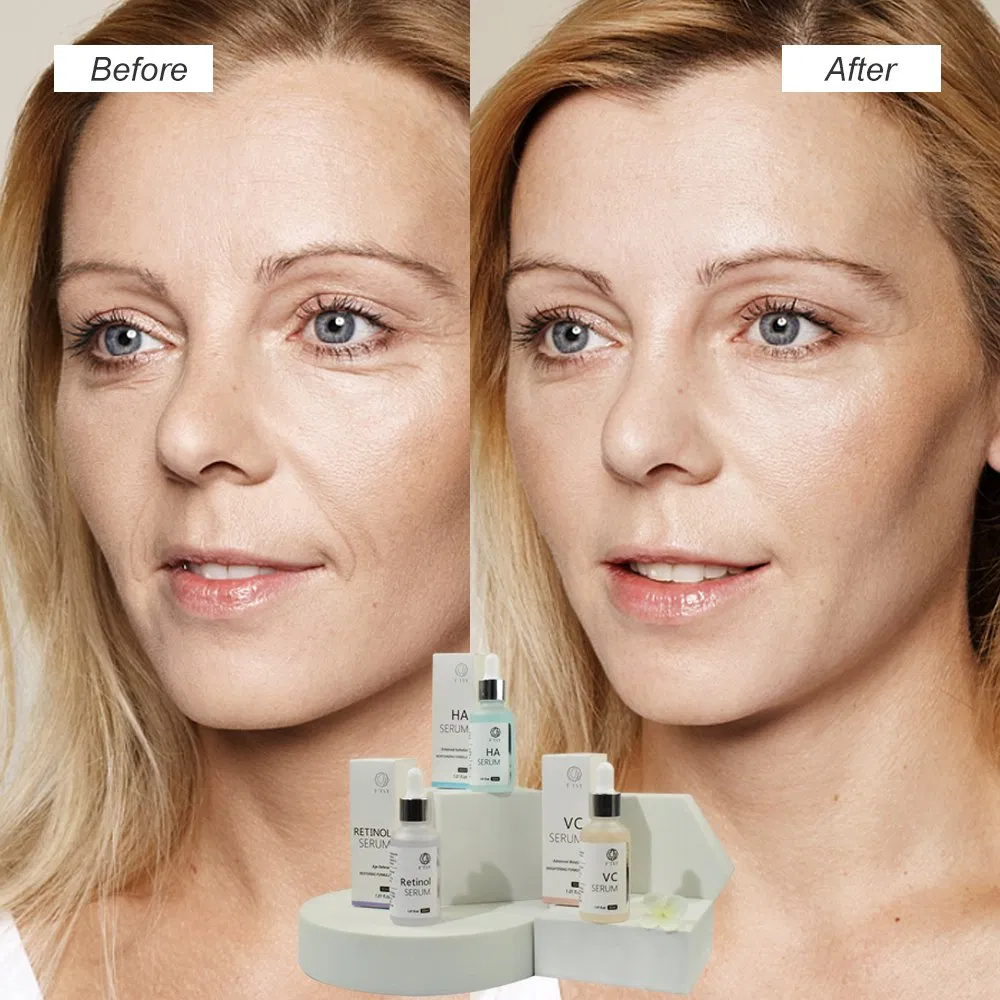 Hot Selling Whitening Vitamin C Serum Ha Hydrating Face Serum